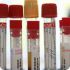 Еще два случая заражения вирусом A/H1N1 выявлены в Италии